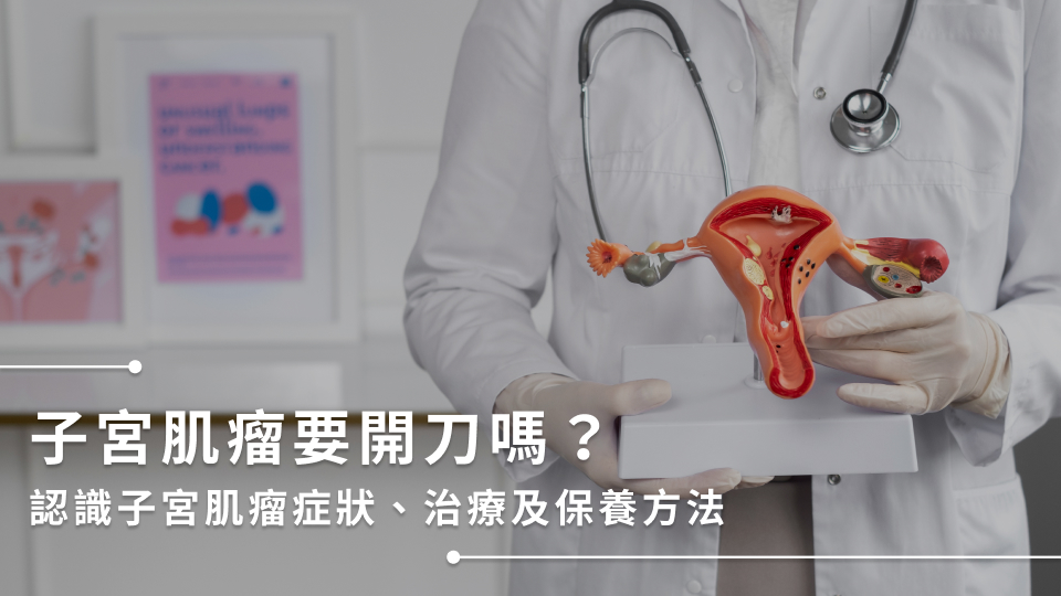子宮肌瘤要開刀嗎?認識子宮肌瘤症狀、治療及保養方法